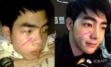 男网红整容脸吃瓜视频,吃瓜群众热议的整形真相  第2张